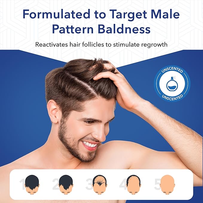 Advanced 5% Minoxidil For Men Hair Regrowth Treatment for Thinning Hair - Hair Loss for Men - 1 Month Supply, Minoxidil Topical Solution So Thicker Fuller Hair Keeps Growing Amazing Results