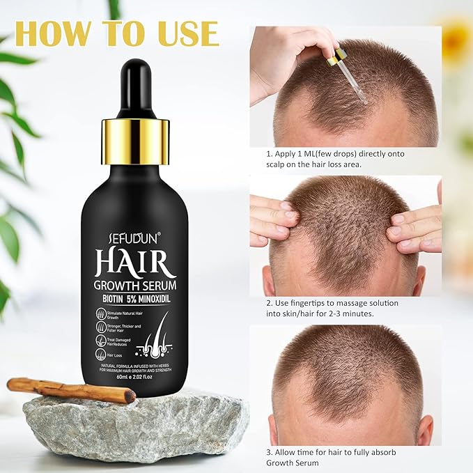 2Pack 5% Minoxidil for Men & Women, Minoxidil for Women Hair Growth, Minoxidil for Men Beard, Natural Hair Regrowth Treatment for Hair Loss Hair Thinning, Thicker Fuller Healthier Hair