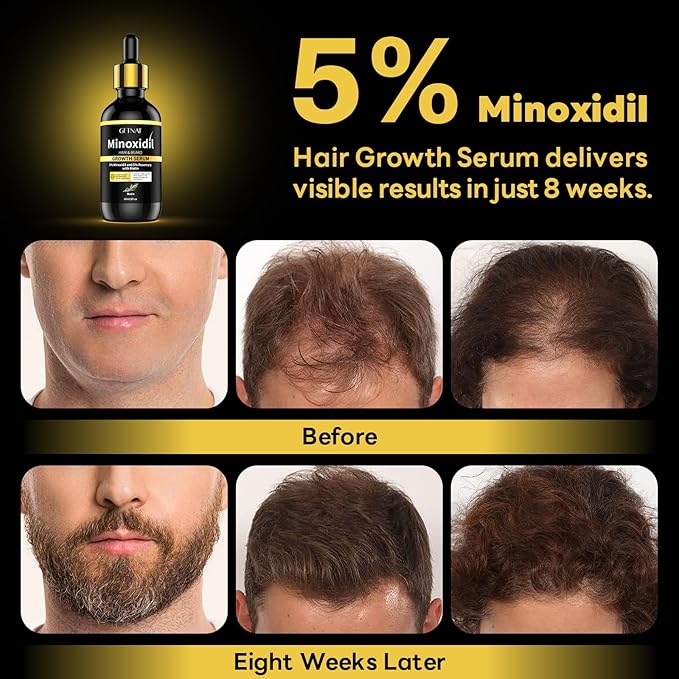 5% Minoxidil with Rosemary for Men and Women Hair Growth,Beard Growth Kit,Scalp Serum for Thicker Fuller Hair